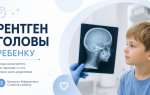 Рентген головы ребенку